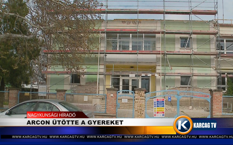 ARCON ÜTÖTTE A GYEREKET